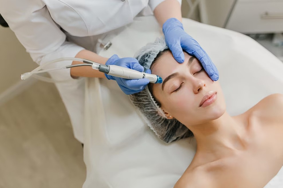 Rejuvenecimiento REFRESH Tratamiento Facial con Tratamiento con IPL y ácido hialuronico
